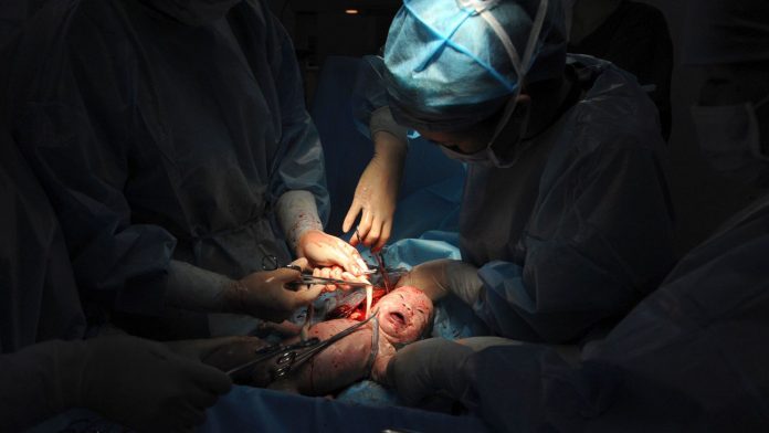 photo-d-illustration-des-medecins-coupent-le-cordon-ombilical-d-un-nouveau-ne-lors-d-une-cesarienne-a-l-hopital_5763093